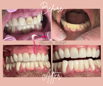 Slider image (6) Dr. Alejandra Rodarte Cosmetic & Implant Specialist